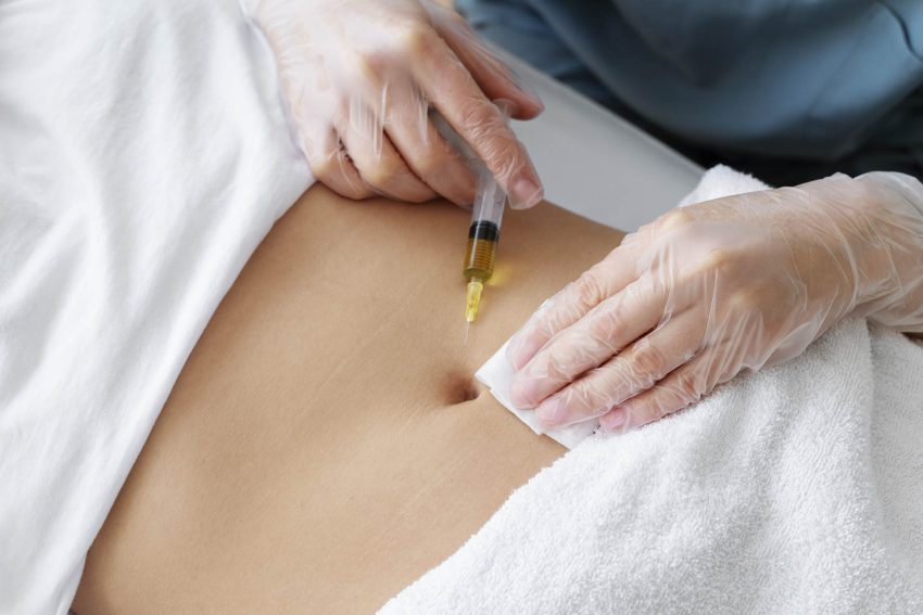 Mesoterapia | Dermoestética
