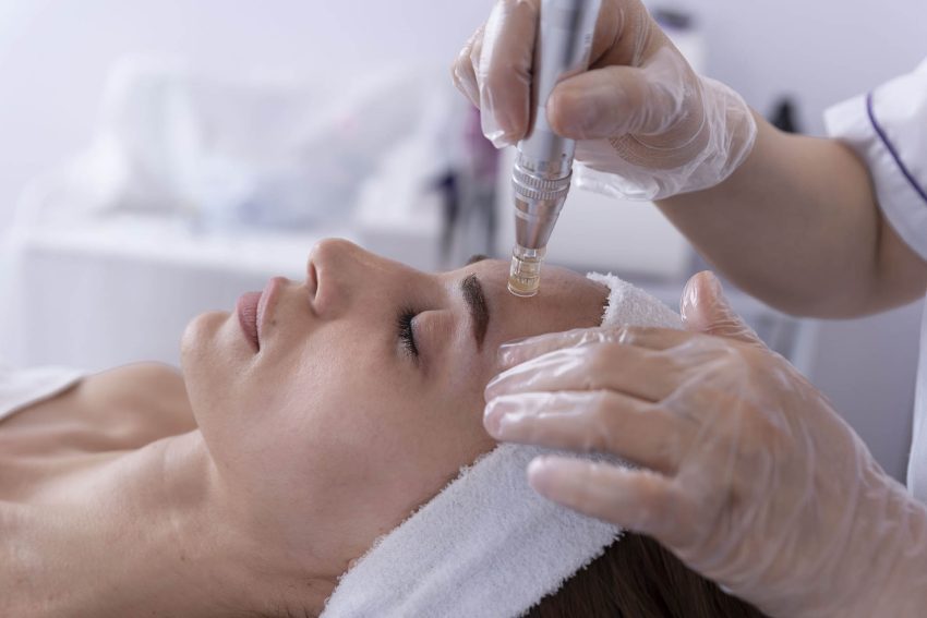 Microneedle | Dermoestética