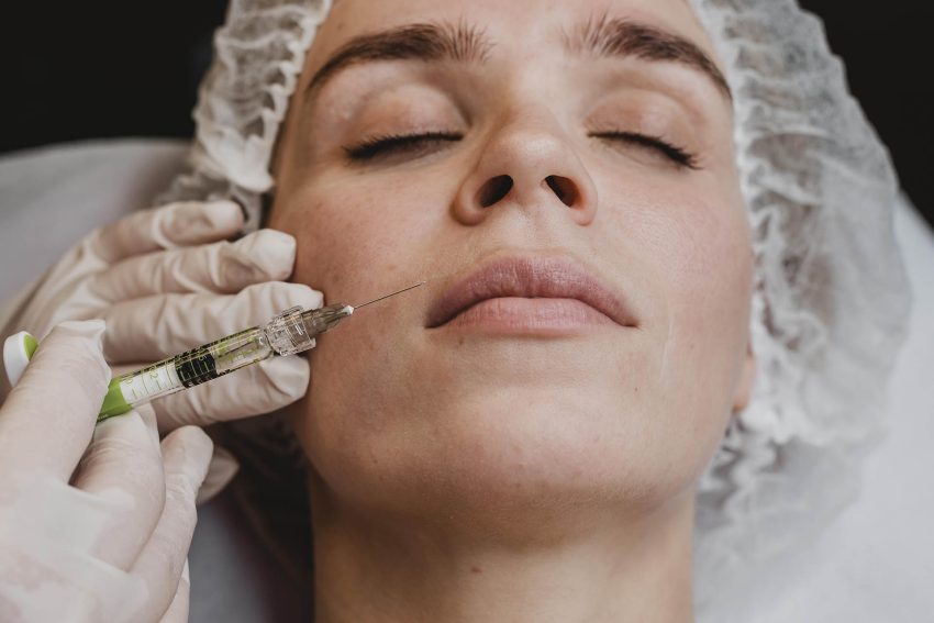 Relleno de labios con ácido hialurónico | Dermoestética